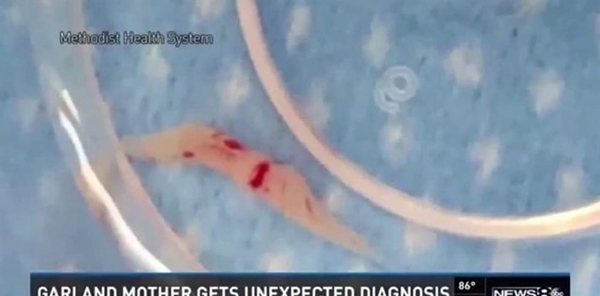 Foto - Doktorlar hayrete düştü