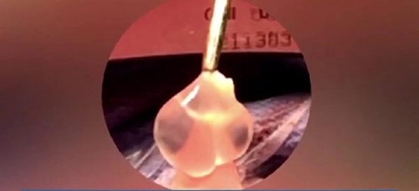 Foto - Doktorlar hayrete düştü