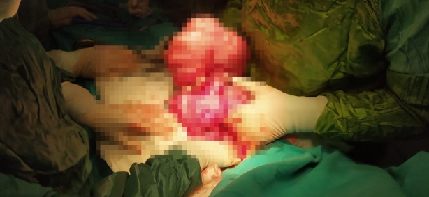 Foto - Doktorları bile şaşkın! Gerçek hastanede ortaya çıktı