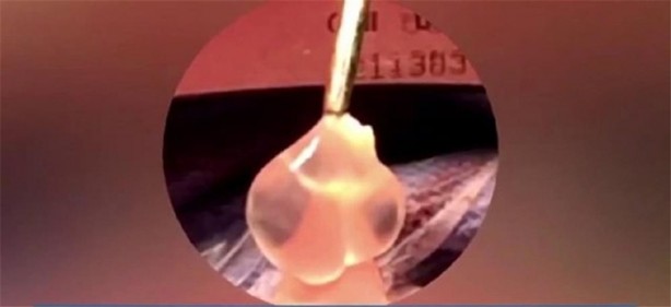 Foto - Doktorları şaşırtan görüntü