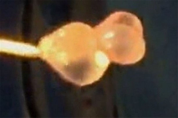 Foto - Doktorları şaşırtan görüntü