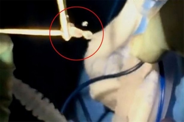 Foto - Doktorları şaşırtan görüntü