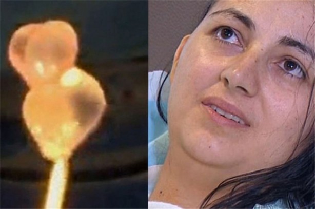 Foto - Doktorları şaşırtan görüntü