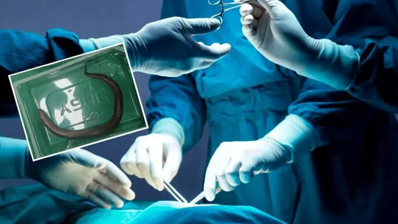 Doktorları şaşkına çeviren vaka: Karnından çıkana inanamadılar!!!