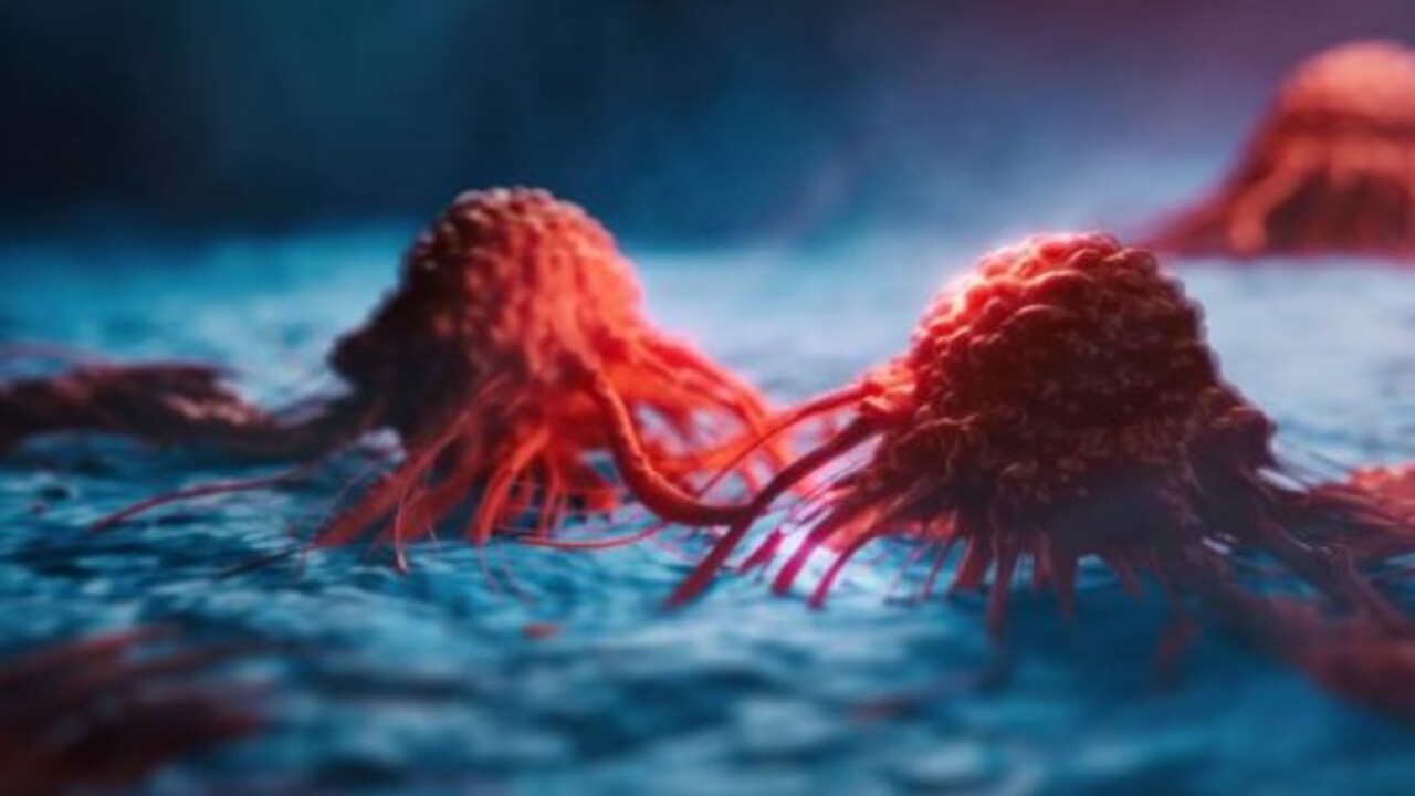 Foto - Doktorların bile gözünden kaçtı! Kalça ağrısı sandı bağırsak kanseri çıktı