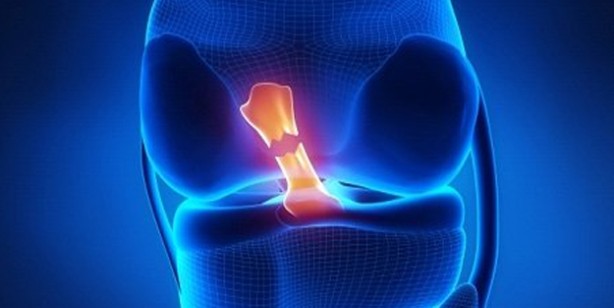 Doktorların şaşırdığı tarif dizleri yeniliyor ve iyileştiriyor: İyi gelen, sık yapılan karışımı hesaba katın! Etki ediyor