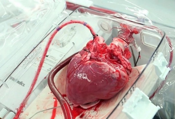 Foto - ABD'li bilim insanları domuz bedeninde insan organı yetiştirilecek