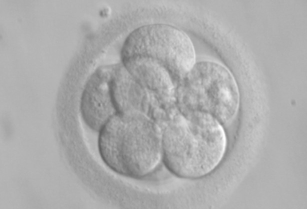 Foto - ABD'li bilim insanları domuz bedeninde insan organı yetiştirilecek