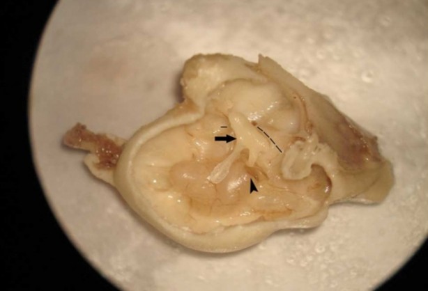 Foto - ABD'li bilim insanları domuz bedeninde insan organı yetiştirilecek