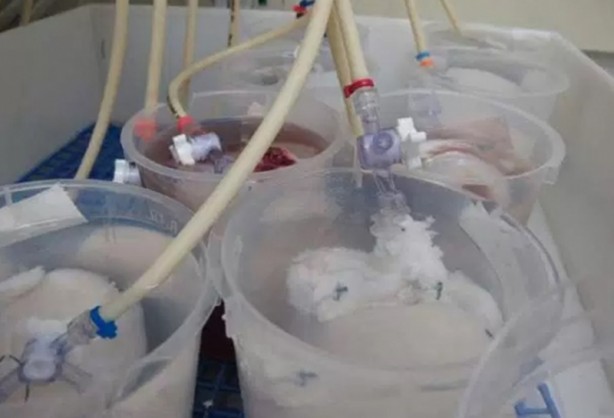 Foto - ABD'li bilim insanları domuz bedeninde insan organı yetiştirilecek