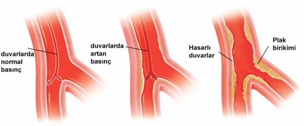 Foto - Dondurmayı kaşıkla yiyenler dikkat! Bu ayrıntı dikkat çekti