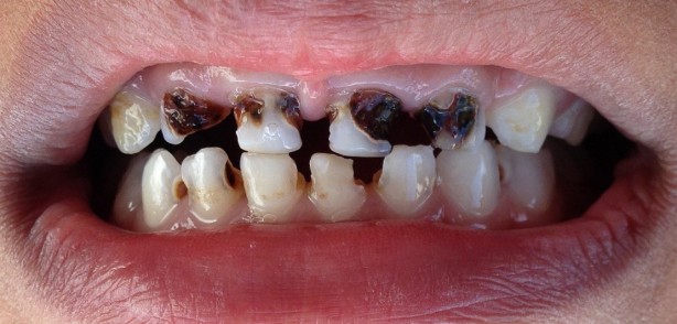 Foto - Dondurmayı kaşıkla yiyenler dikkat! Bu ayrıntı dikkat çekti