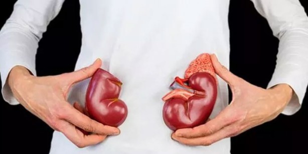 Foto - Donörden alınan böbreğin kan grubunu değiştirdiler