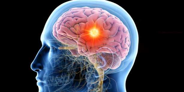 Foto - Dopamin orucu hakkında her şey! Dopaminin azı da çoğu da zarar