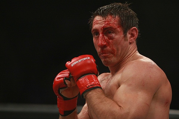 Foto - Dövüşçülerin maç sonu halleri