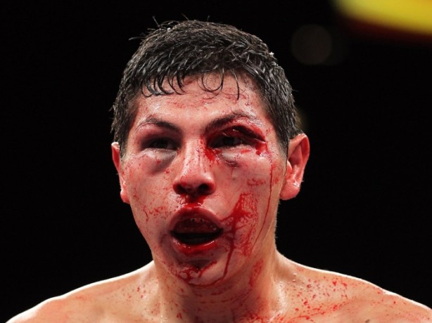 Foto - Dövüşçülerin maç sonu halleri