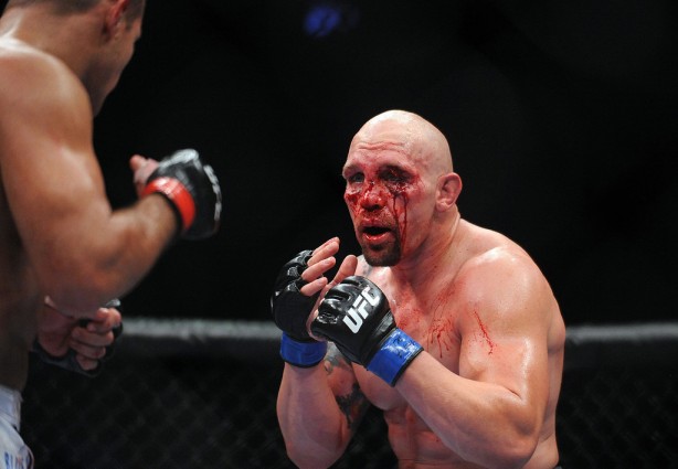 Foto - Dövüşçülerin maç sonu halleri