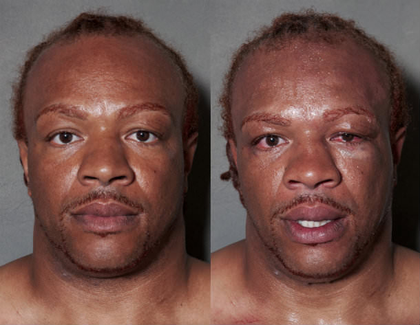 Foto - Dövüşçülerin maç sonu halleri