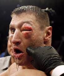 Foto - Dövüşçülerin maç sonu halleri