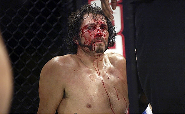 Foto - Dövüşçülerin maç sonu halleri