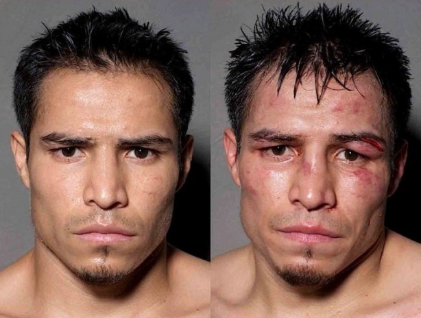 Foto - Dövüşçülerin maç sonu halleri