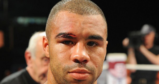 Foto - Dövüşçülerin maç sonu halleri