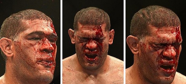 Foto - Dövüşçülerin maç sonu halleri