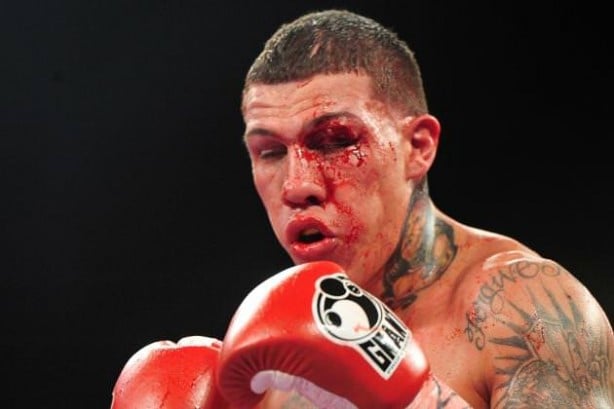 Foto - Dövüşçülerin maç sonu halleri