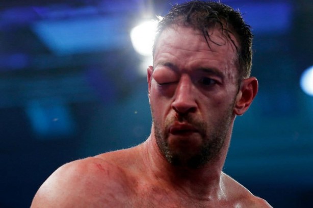 Foto - Dövüşçülerin maç sonu halleri