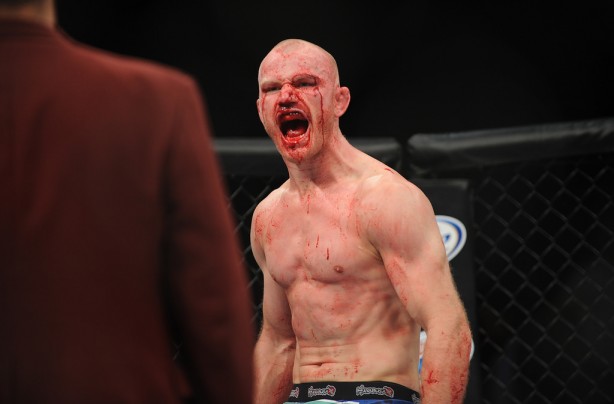 Foto - Dövüşçülerin maç sonu halleri