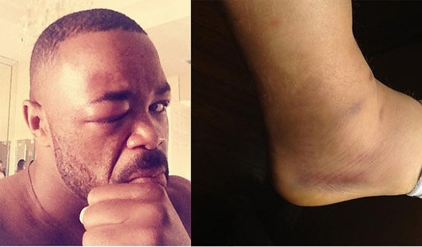 Foto - Dövüşçülerin maç sonu halleri