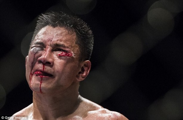 Foto - Dövüşçülerin maç sonu halleri