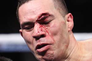 Foto - Dövüşçülerin maç sonu halleri