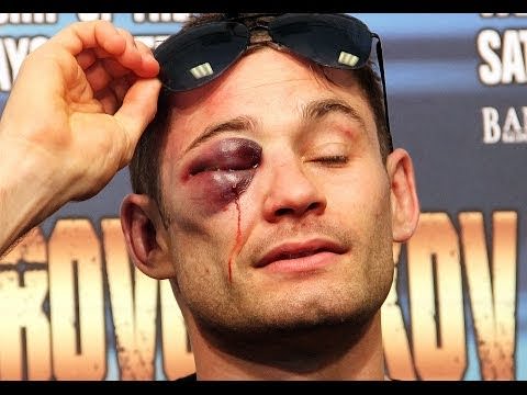 Foto - Dövüşçülerin maç sonu halleri