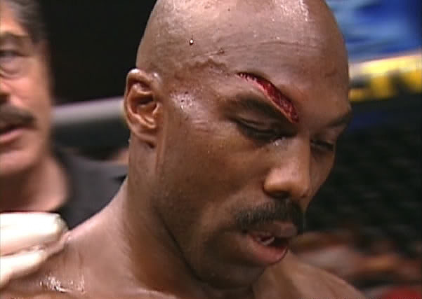 Foto - Dövüşçülerin maç sonu halleri