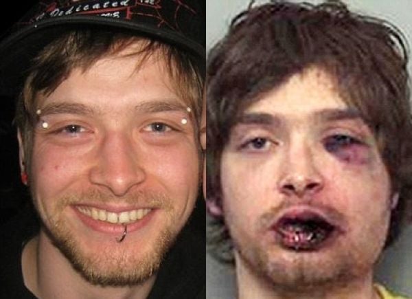 Foto - Dövüşçülerin maç sonu halleri