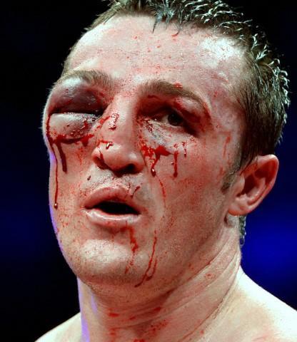 Foto - Dövüşçülerin maç sonu halleri