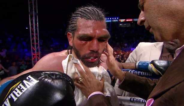 Foto - Dövüşçülerin maç sonu halleri