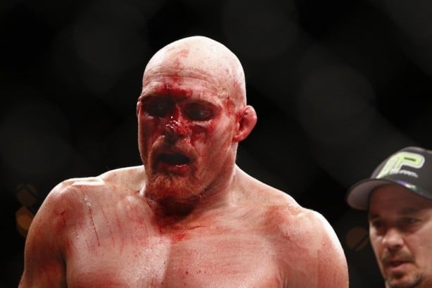 Foto - Dövüşçülerin maç sonu halleri