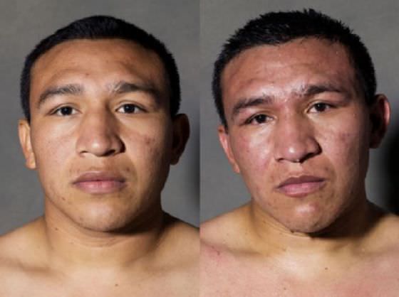 Foto - Dövüşçülerin maç sonu halleri