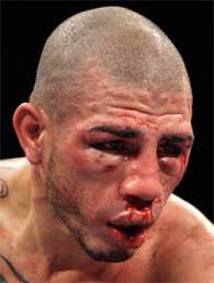 Foto - Dövüşçülerin maç sonu halleri