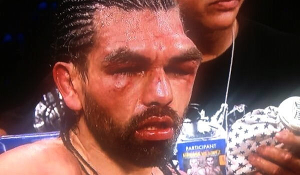 Foto - Dövüşçülerin maç sonu halleri