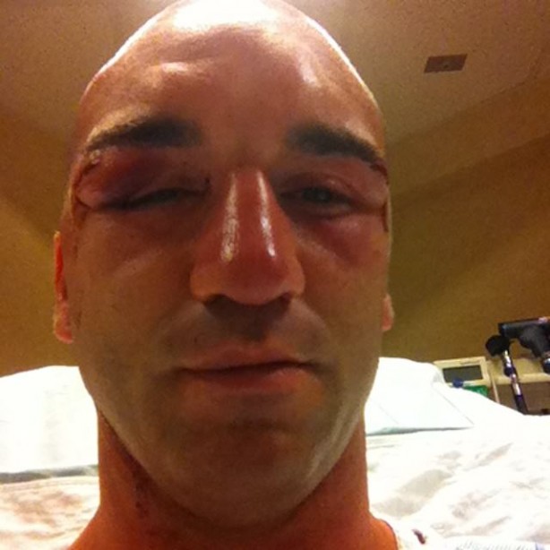 Foto - Dövüşçülerin maç sonu halleri