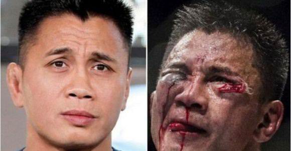 Dövüşçülerin maç sonu halleri