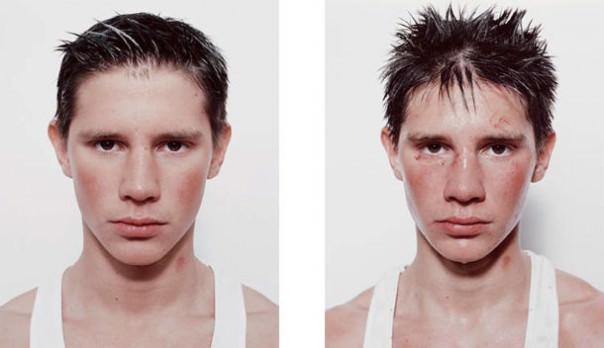 Foto - Dövüşçülerin maç sonu halleri