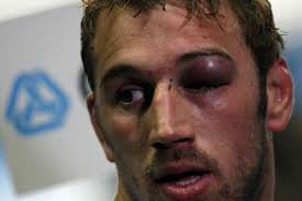 Foto - Dövüşçülerin maç sonu halleri