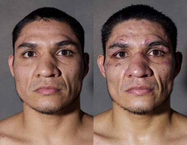 Foto - Dövüşçülerin maç sonu halleri