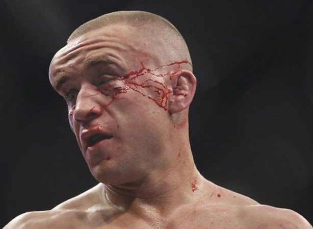 Foto - Dövüşçülerin maç sonu halleri