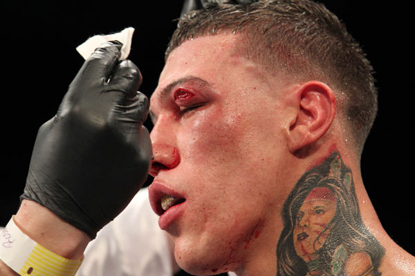 Foto - Dövüşçülerin maç sonu halleri