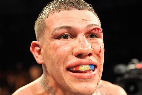 Foto - Dövüşçülerin maç sonu halleri